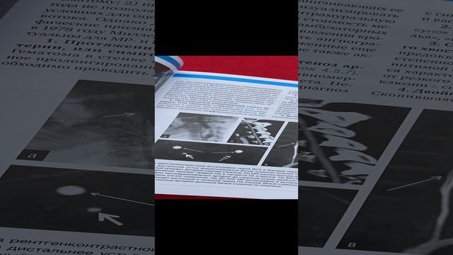 Нейровизуализация. Головной мозг