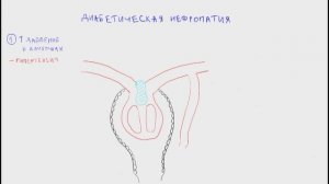 Диабетическая нефропатия - основы патогенеза