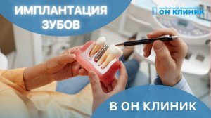 Имплантация зубов в ОН КЛИНИК