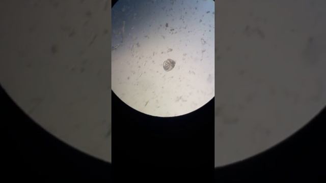 Улитка Неретина зебра. Личинки. Разведение. смотреть онлайн