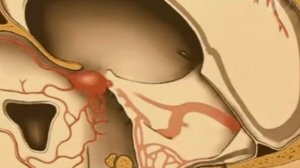Носогубный треугольник / Nasolabial triangle