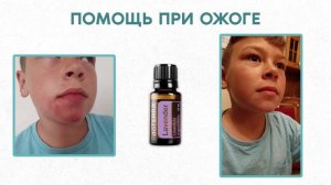 Скорая помощь с Эфирными маслами