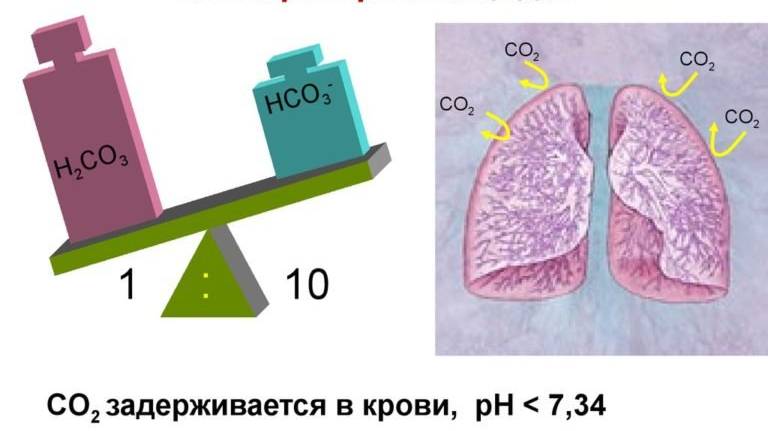 Баланс