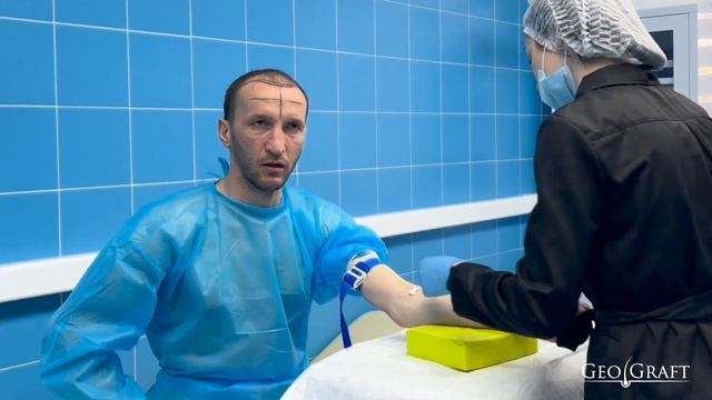 Алан Гатагов в GeoGraft. Пересадка волос в Москве.