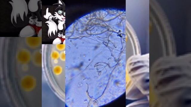 Микробы в водорослях под микроскопом