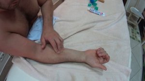 Самомассаж руки посте инсульта