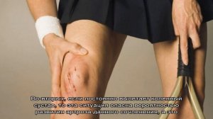 Вывих колена