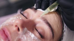 Плазмолифтинг