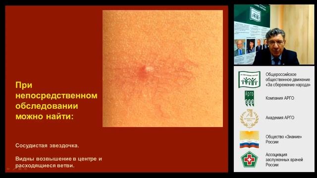 Лекция №3 курса “Эксперт ЗОЖ” Печень - фабрика нашего организма смотреть онлайн