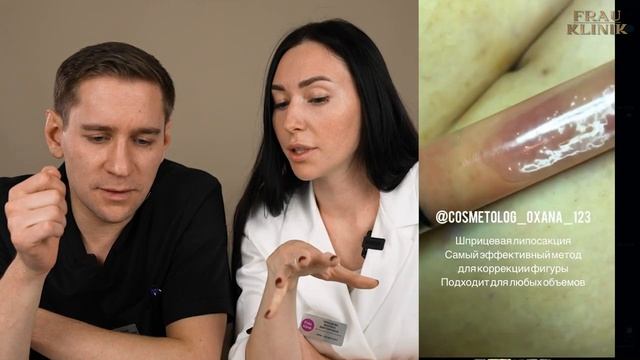 КосмеДичка. Обзор неудачной ХИРУРГИИ И КОСМЕТОЛОГИИ смотреть онлайн