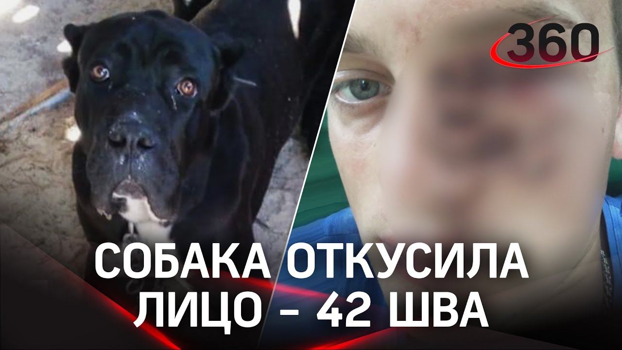 Собака съела пол-лица будущему зятю в коттеджном посёлке под Вологдой. Кане-корсо не любит пьяных