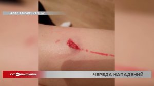 Второй случай за неделю: собаки напали на девочку в Иркутске