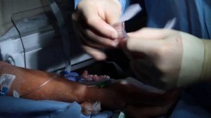 Эндоваскулярная   Стентирование Трансрадиальный TR Band Гемостаз Terumo