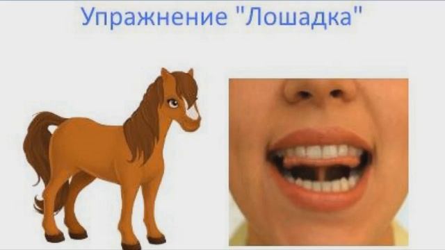 Лошадка артикуляционная гимнастика картинка