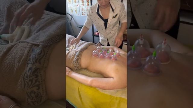 Баночный массаж