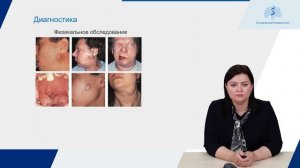 Рак слюнных желез (С07, С08)