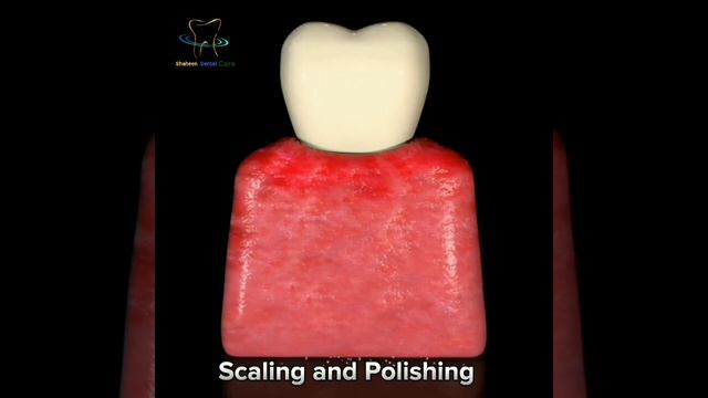 dental treatment pain bridges advice bleeding braces canal cavity check