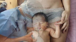 ЭКСТРЕННОЕ КЕСАРЕВО СЕЧЕНИЕ | Как можно подстраховаться на случай экстренного кесарева сечения