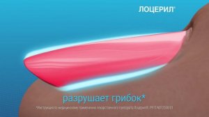 Лоцерил_Подарите свободу ногам!