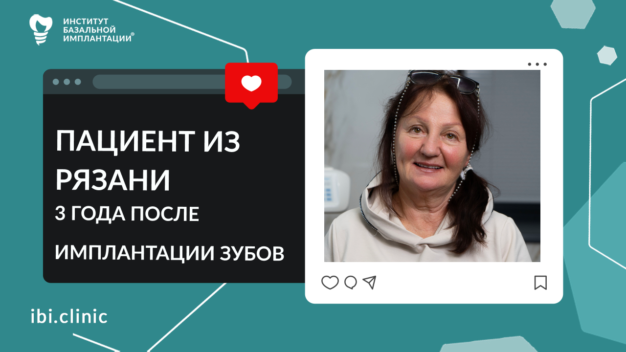 Отзыв пациентки после имплантации зубов, спустя 3 года