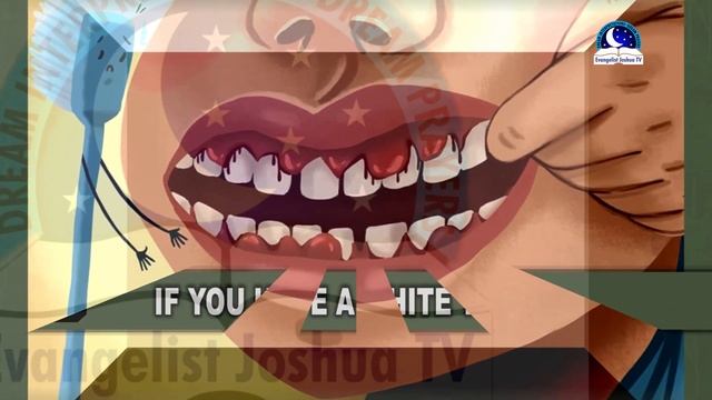 DREAM ABOUT ROTTEN TEETH - Evangelist Joshua Orekhie Dream Dictionary смотреть онлайн