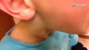 Попугай вырвал зуб / Parrot dentist