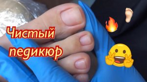 Чистый педикюр????