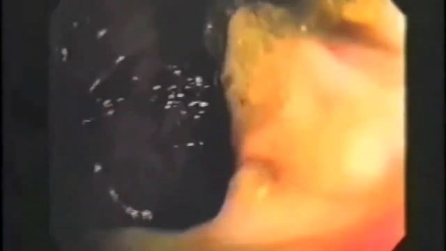 Японский доктор Хироми Шинья. Лечение через очищение кишечника.