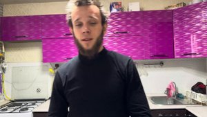 Самый Честный отзыв о Миноксидиле | Волосы выпадают ?