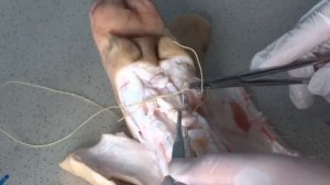 Сухожильный шов кракова