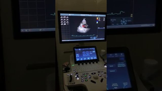Video 3: Echocardiography/Heart ultrasound/2D смотреть онлайн