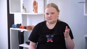 Ампутация. Оказалось это не так страшно: Светлана | История пациента INSTEP