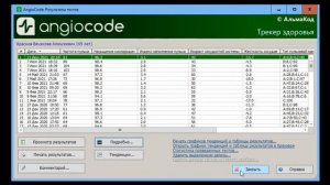 AngioCode-301 | обзор интерфейса на ПК, проведение теста и просмотр результатов