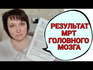 С ГОЛОВОЙ ВСЕ ПОНЯТНО