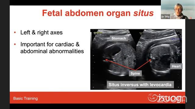 ISUOG Basic Training Course on Ultrasound in Obstetrics and Gynecology смотреть онлайн