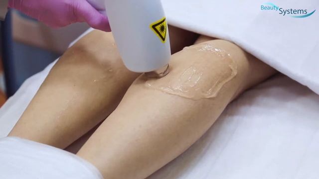 Услуги лазерной Эпиляции смотреть онлайн