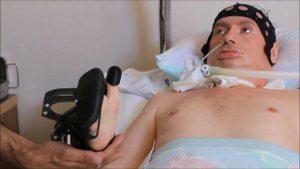 Больной БАС управляет экзоскелетом руки с помощью нейро-компьютерного интерфейса