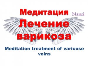 Медитация Лечение варикоза / Meditation treatment of varicose veins