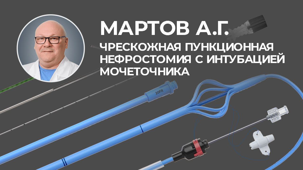 Чрескожная пункционная нефростомия с интубацией мочеточника. Отзыв Мартова Алексея Георгиевича.