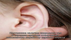Почему в ушах образуется много серы