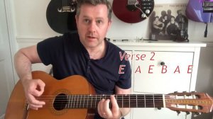 Queen I Want To Break Free Acoustic Guitar Lesson