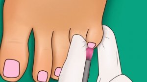 ASMR] Ingrown Toenail Removal | Nail Care Salon Animation | Ondong | Happy Lemon