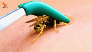 Он дал свою руку укусить пчеле