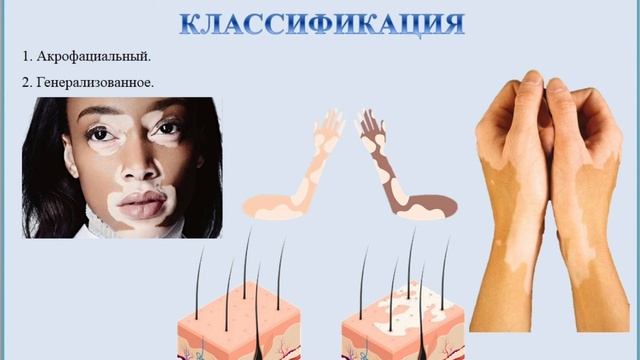 7. ВИТИЛИГО – ЗАГАДКА ПРИРОДЫ смотреть онлайн