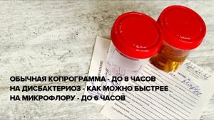 Сколько и как хранить анализы кала и мочи в холодильнике