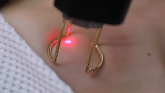 Лазерное омоложение на новом аппарате Fraxor смотреть онлайн