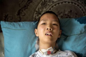 Эрдэни Аюшеев, 12 лет, последствия тяжелой закрытой черепно-мозговой травмы. Требуется 1 351 200 руб