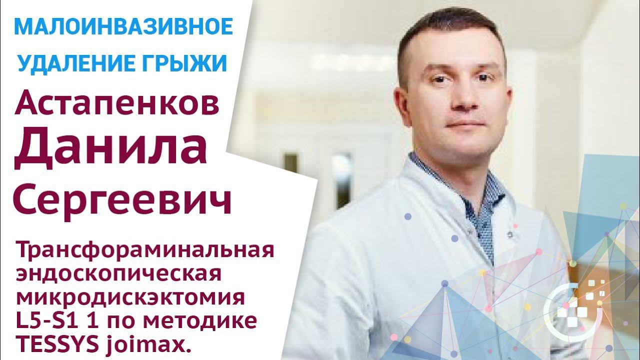 Трансфораминальная эндоскопическая микродискэктомия L5 S1 1 смотреть онлайн