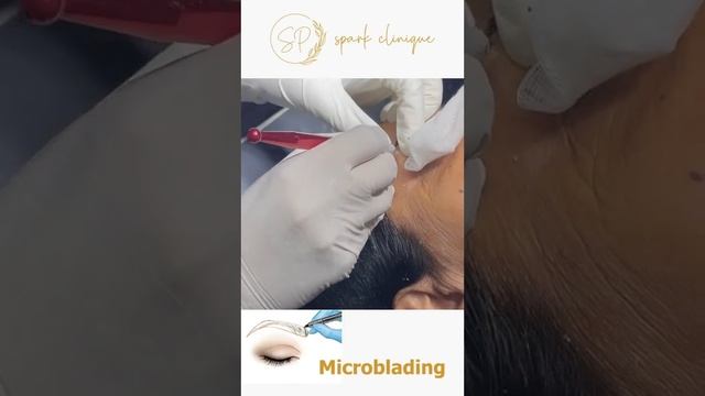 Microblading Eye Brows Process by Dr Shalu Punj | Microblading Process  #microbladingeyebrows