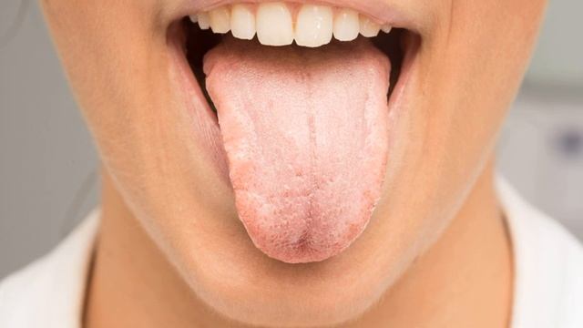 Как быстро избавиться от запаха изо рта смотреть онлайн